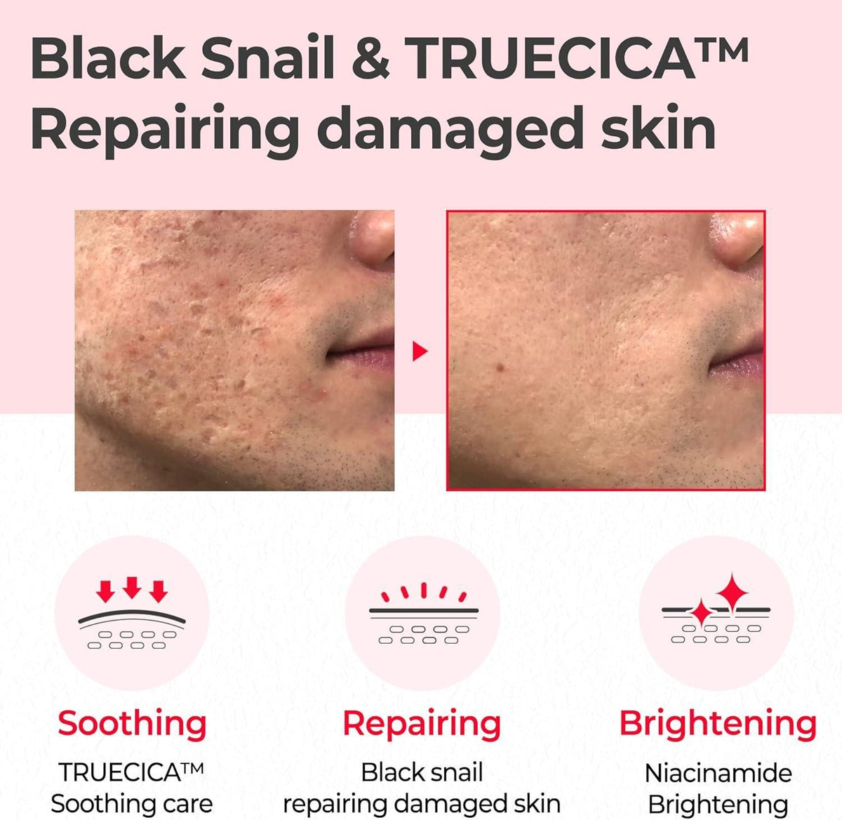 [SOME BY MI] Snail Truecica Miracle Repair Toner 150ml