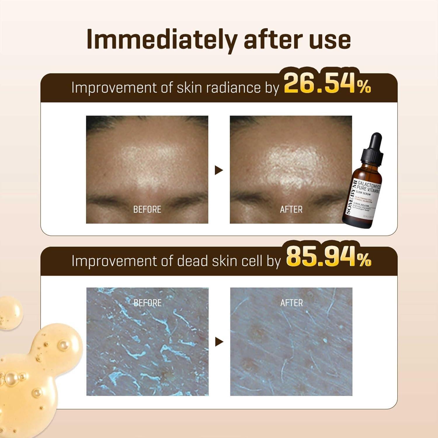 [SOME BY MI] Galactomyces Pure Vitamin C Glow Serum 30ml