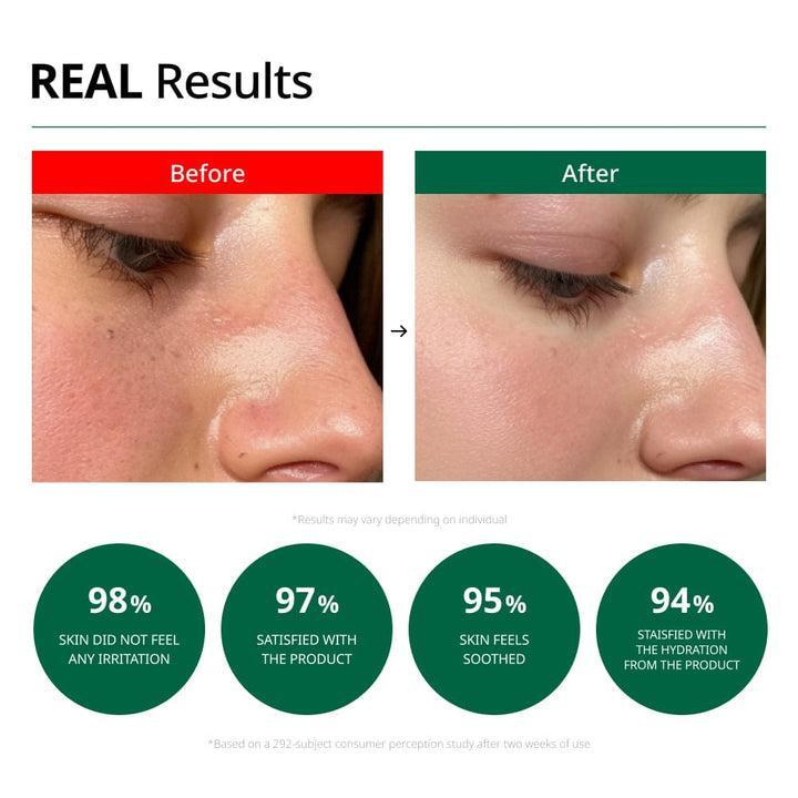 [Dr.G] Crème Apaisante Rougeurs et Imperfections Clear Blemish 70ml