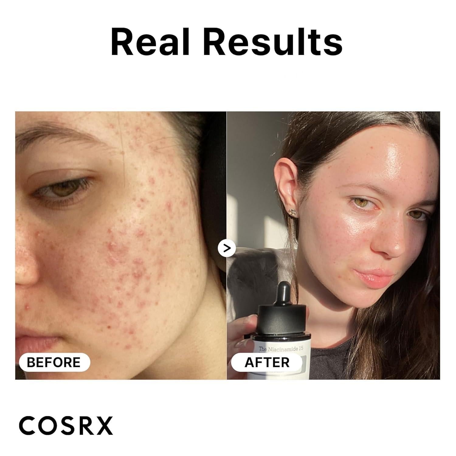 [COSRX] The Niacinamide 15 Serum 20ml