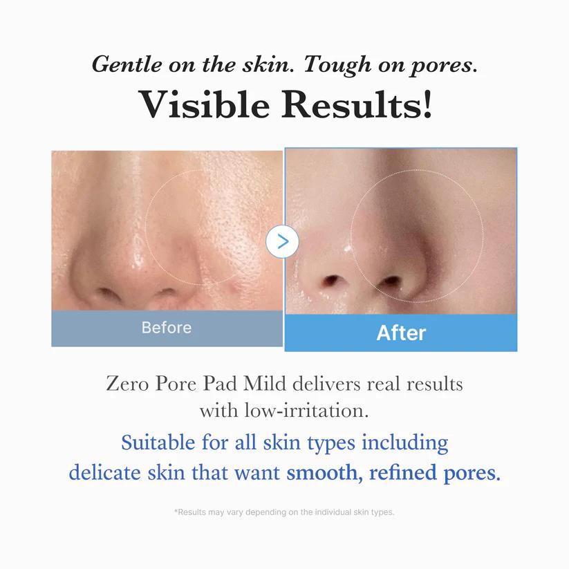 [Medicube] Zero Pore Pad Mild 70 pads
