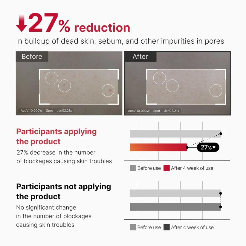 [Medicube] Red Acne Body Peeling Shot 110ml